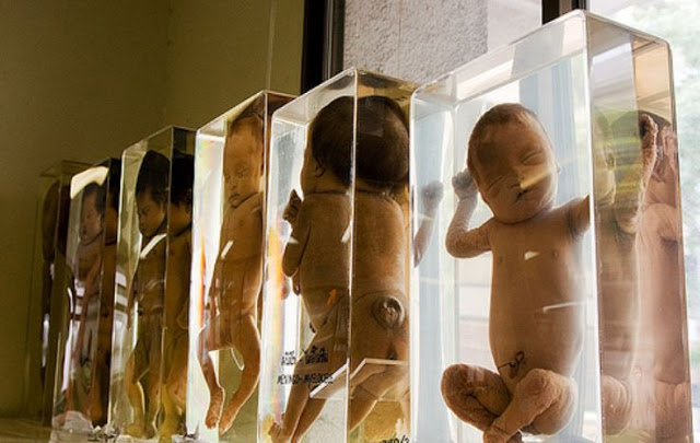 Siriraj Medical Museum